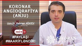 Koronar angioqrafiya (anju) Dr Mehman Agayev kardioloq invoziv kardioloq Zeferan Hospital Medplus TV