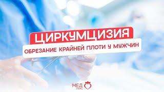 ЦИРКУМЦИЗИЯ | ОБРЕЗАНИЕ КРАЙНЕЙ ПЛОТИ У МУЖЧИН