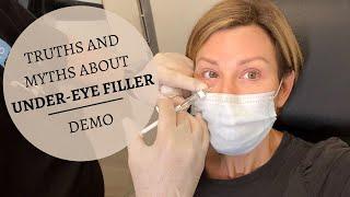 UNDER EYE FILLERS Before & After | Restylane Results, Truths & MYTHS | Dominique Sachse