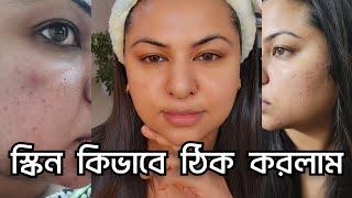 The Secret to Improving Skin Texture || Ananya Artistry