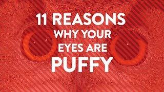 11 Reasons Why Your Eyes Are Puffy | Health