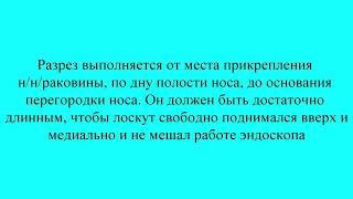 25-Максилотомия через нижний носовой ход (эндоскопическая)