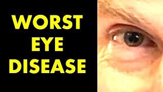 UNDERSTAND Dry Macular Degeneration? Discover the Secrets!