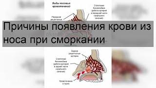 Причины появления крови из носа при сморкании