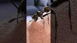 Stunning Way Ants Bite