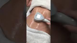 Exilis Ultra 360 - Modela e Tonifica 