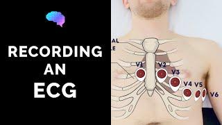 How to record an ECG - OSCE Guide | UKMLA | CPSA