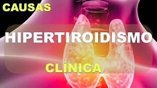 Hipertiroidismo: causas y síntomas (Graves, Adenoma...)