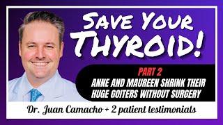 Thyroid Arterial Embolization in SARASOTA: Dr. Juan Camacho - #79 PART 2