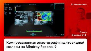 Компрессионная эластография щитовидной железы (Strain Elastography) на Mindray Resona i9