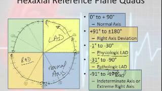 12 Lead Interpretation Part 3: R-wave Progression, Electrical Vectors & Axis Deviations