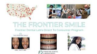 The Frontier Smile DTC Campaign Explained