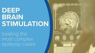 Deep Brain Stimulation For Epilepsy - Yale Medicine Explains