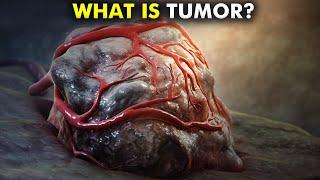 How Tumors are formed? Types of Tumors 3d animation