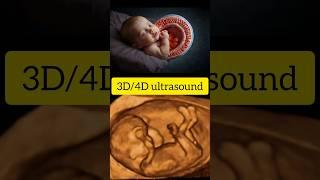 3D/4D ultrasound||boy or girl