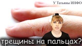 ТРЕЩИНЫ на РУКАХ или НОГАХ и что с ними делать???