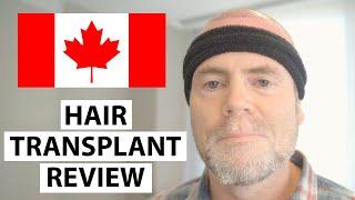 HELLO CANADA! Ross's Hair Transplant Experience at AEK Hair Clinic