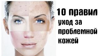 10 ПРОСТЫХ ПРАВИЛ/ Как ухаживать за проблемной кожей