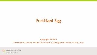 Fertilized Egg