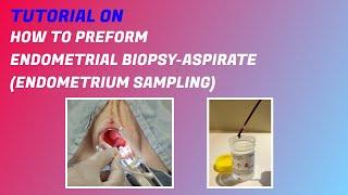Endometrial Biopsy-Aspirate (Endometrium sampling) Procedure