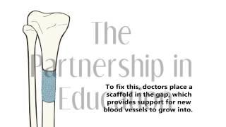 Bone Scaffold Animation | The Partnership in Education