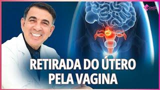 CIRURGIA DE RETIRADA DO ÚTERO PELA VAGINA - HISTERECTOMIA POR VIA VAGINAL