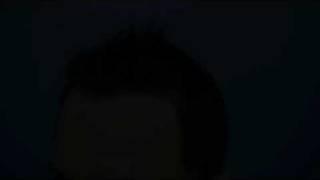 Hair Transplant by Dr.Jerry Wong- 2319 grafts- 10.5 months after