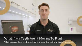 What If My Teeth Aren’t Moving To Plan? | The Good Dentist 