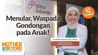 Ask The Expert: Menular, Waspada Gondongan pada Anak