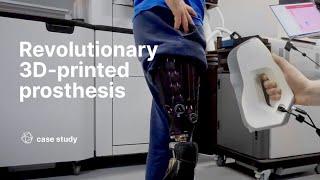 Creating a revolutionary 3D-printed prosthesis with Artec 3D