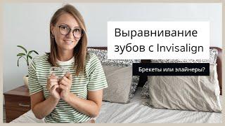 Мой результат выравнивания зубов с Invisalign(Инвизилайн) | Что выбрать: брекеты или элайнеры (капы)