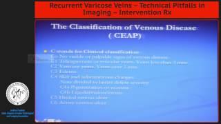 Recurrent Varicose Veins – Technical Pitfalls in Imaging – Intervention Rx