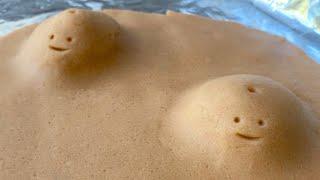 Playdough Surgery - Cyst Pop 