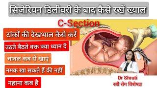 सिजेरियन डिलीवरी के बाद अपना ख्याल कैसे रखें। C-Section । Care after Cesarean delivery-Dr Shruti