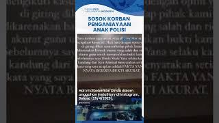 Sosok Korban Penganiayaan Anak Polisi Medan Ternyata Adik Selebgram Dinda Safay