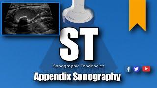 Appendix Ultrasound