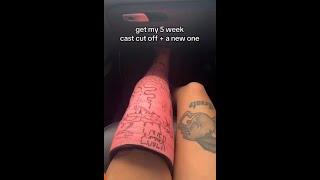 Mechanical bull gone wrong, full leg cast, crutches  then a slc
