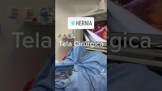 Tela cirúrgica usada em cirurgias de #hernia.