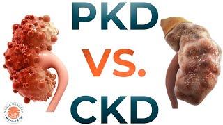 PKD vs CKD - What are the differences?