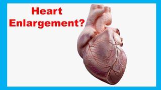 What Causes the Heart to Enlarge?