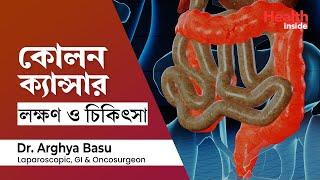 কোলন ক্যান্সার কেন হয় ? কোলন ক্যান্সারের লক্ষণ ও চিকিৎসা | Colon cancer symptoms and treatment