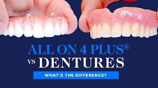 All On 4 Plus® vs Dentures | What Are The Differences?