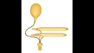 Inflatable penile prosthesis AMS 700IZ LGX - live from OR. Фаллопротезирование AMS700 LGX  - живая