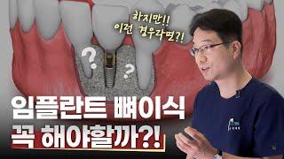 임플란트 뼈이식, 누가? 언제? 어떻게? 왜! 해야할까| 임플란트 뼈이식의 모든 것 알려드립니다‼️