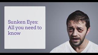 How to get rid of sunken eyes  How to get rid of sunken eyes naturally New Video