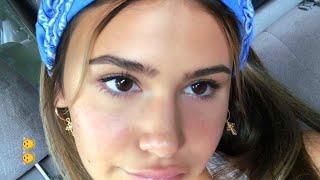 ღ your eyes are so big! ~ lateral canthoplasty procedure 