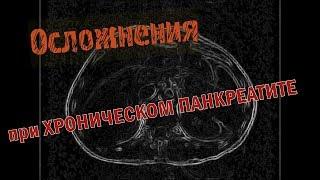 Диагноз ХРОНИЧЕСКИЙ ПАНКРЕАТИТ на расшифровке МРТ брюшной полости  Второе мнение врача проф  Холина