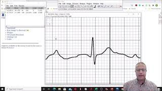 EKG  Lab: Using ImageJ to measure EKG waves, segments, and intervals