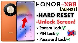 How To Factor Reset honor X9B 5g | Honor x9b password reset | How To Reset honor X9B (ALI-NX1)️️️