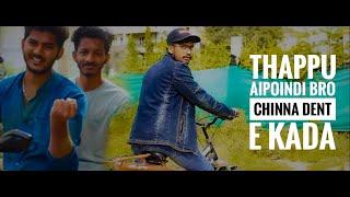 Alvin shannu || Thappu Aipoindi Bro ! — Chinna Dent E kada ...